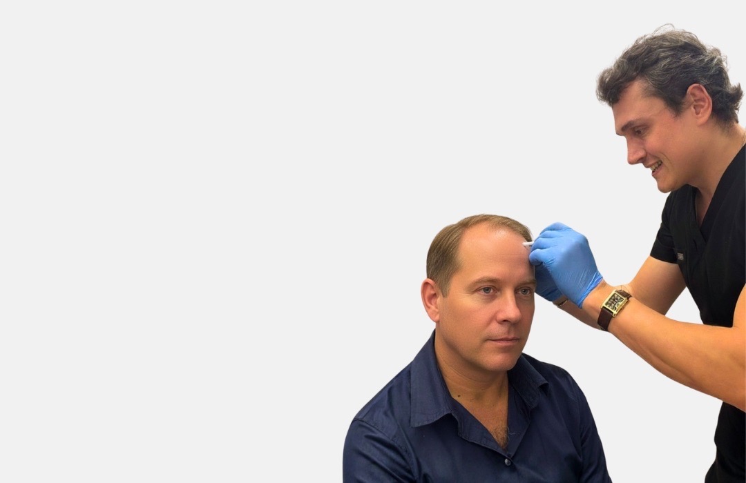 medet hair, hair transplant, hair restoration
