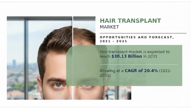 Hair Transplant Market Size and Trends