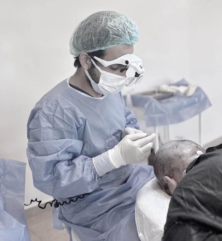 Why Choose Medet Hair for Your Hair Transplant in Turkey?